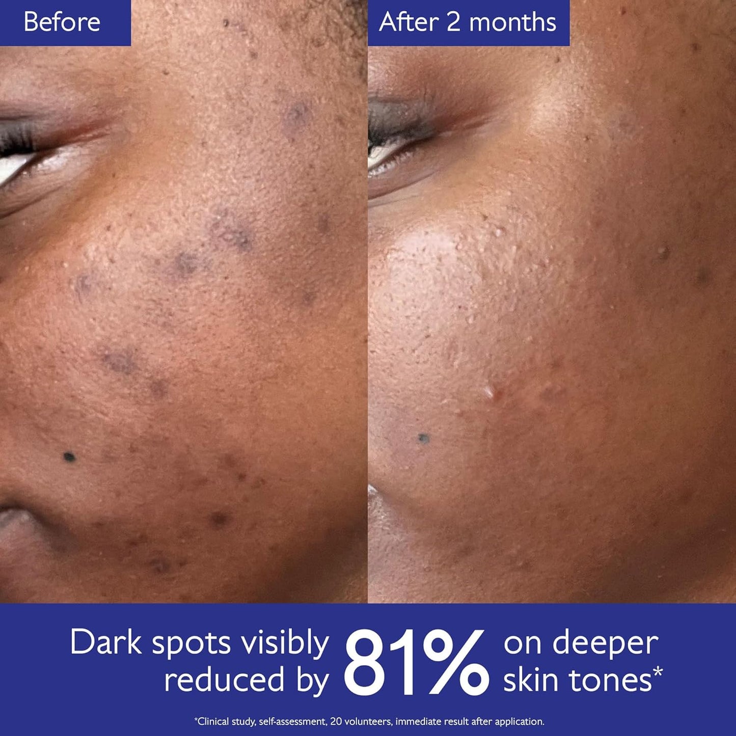 Caudalie Vinoperfect Brightening Dark Spot Serum Vitamin C Alternative - 62x More Effective than Vitamin C with Viniferine for a Visibly Brighter Even Complexion